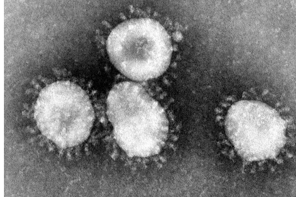 coronavirus