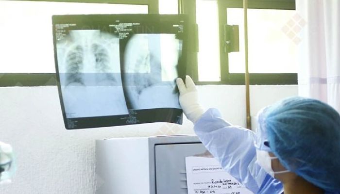 Covid-19-radiografía-hospital_opt