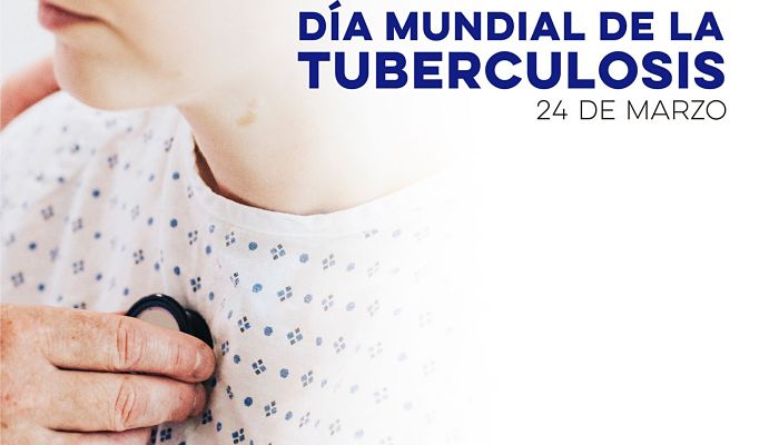 tuberculosis en Sonora_opt