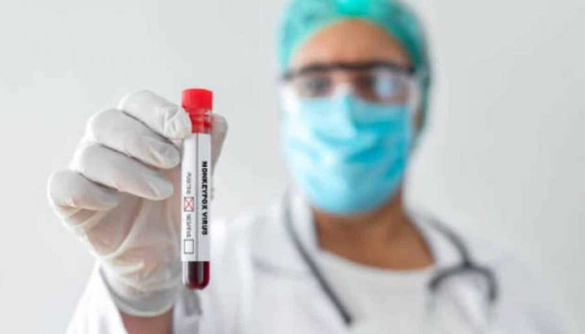 viruela-del-mono-personal-medico