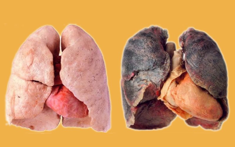 pulmones
