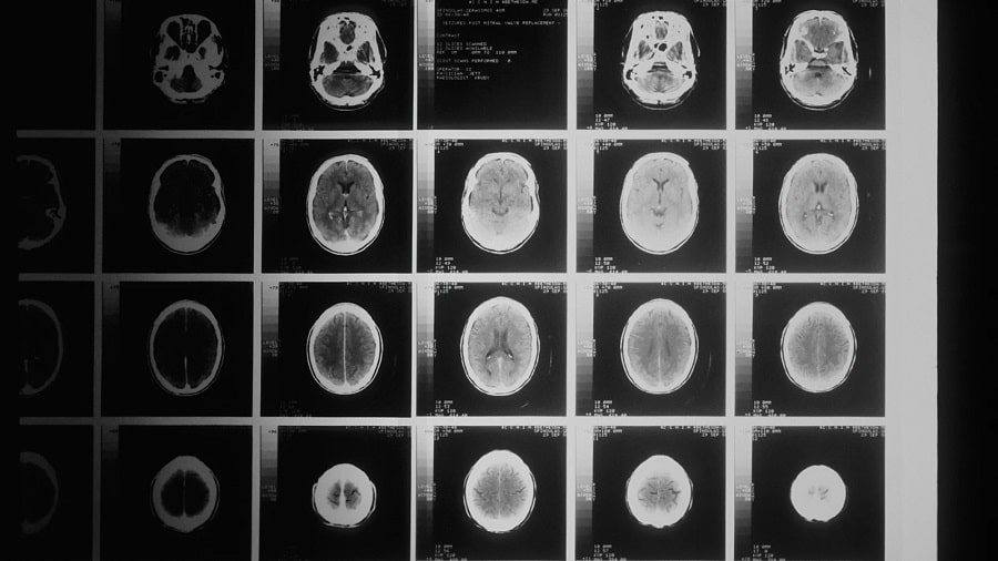 escaneres-cerebro....-min