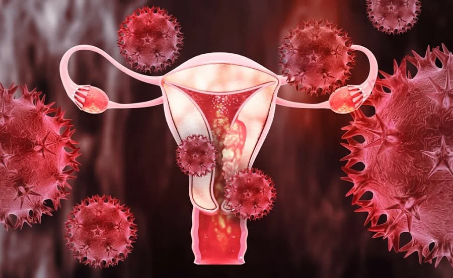 endometriosis.enfermedad silenciosa-min