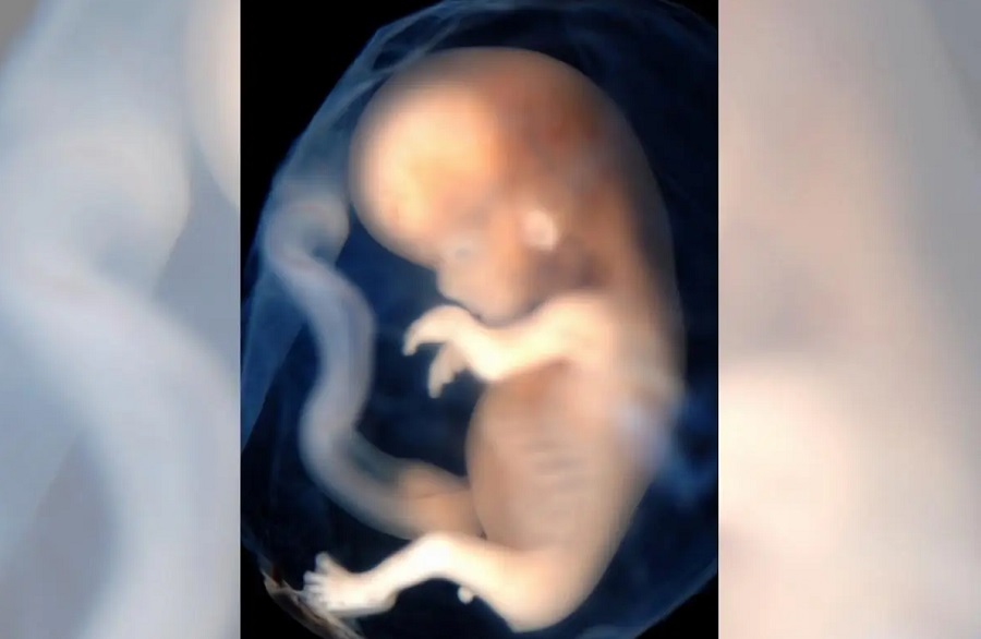 Aborto-min