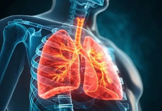 Sanofi anuncia una nueva terapia biológica para tratar la EPOC en México-min