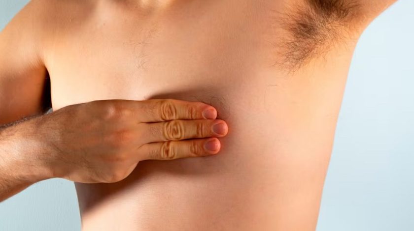 cancer de mama en hombres-min