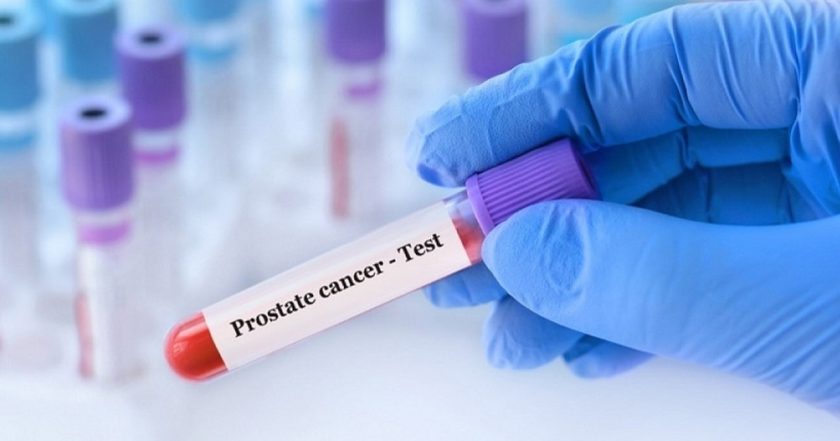 nueva conbinación de medicamentos reduce muere por cáncer-min