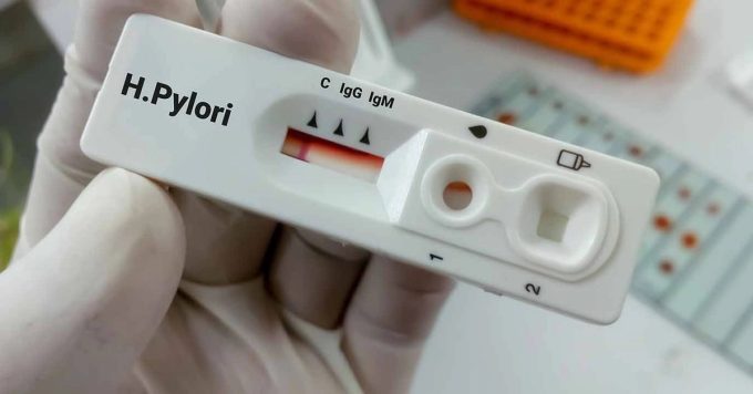 en-70-de-mexicanos-bacteria-asociada-al-cancer-gastrico-min