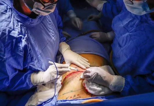 prohibido cirujia estetica a menores-min