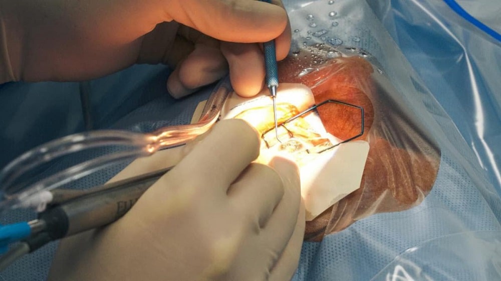 Secretaría de Bienestar realiza cirugías gratuitas-min