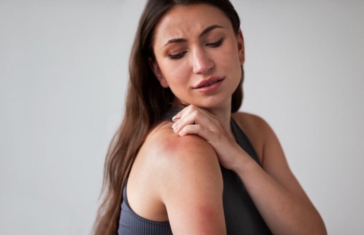 dermatitis dia mundial (1)